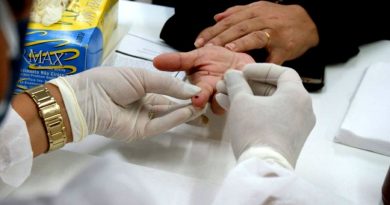 Com objetivo de atrair público-alvo, campanha oferece voucher de R$ 50 para quem fizer teste de HIV